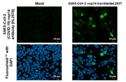 Anti-SARS-CoV-2 (COVID-19) nsp14 antibody [HL2578] used in Immunocytochemistry/ Immunofluorescence (ICC/IF). GTX638956